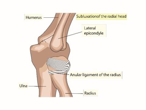 extremity