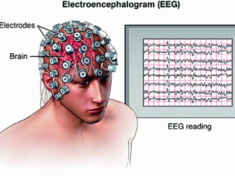 electroencephalogram