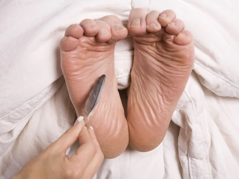tickling