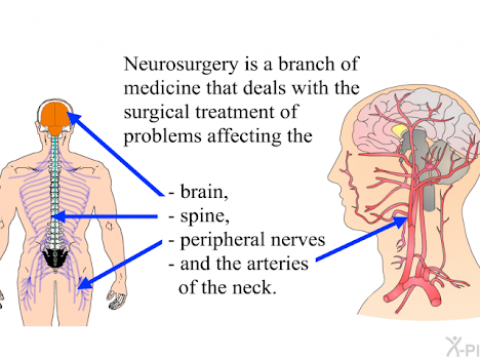 neurosurgery