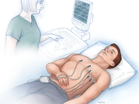electrocardiographic