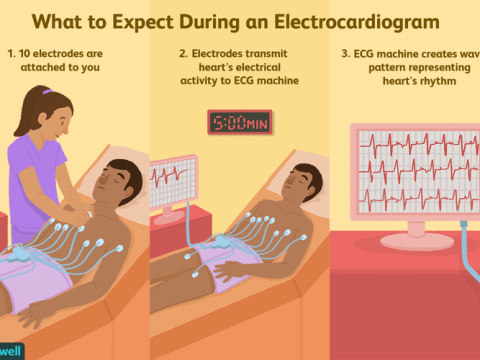 electrocardiograph