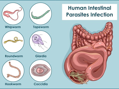 parasite